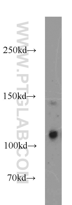 WB analysis of MCF-7 using 12087-2-AP