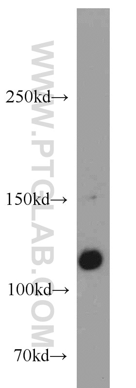 Western Blot (WB) analysis of DU 145 cells using CDA1 Polyclonal antibody (12087-2-AP)