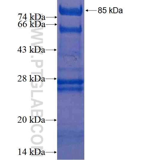 TSPYL2,TSPX,NP79 fusion protein Ag2722 SDS-PAGE