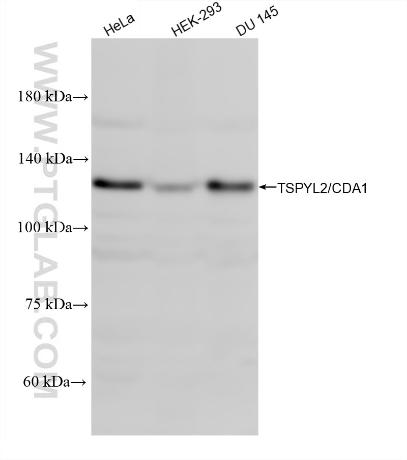 Western Blot (WB) analysis of various lysates using TSPYL2/CDA1 Recombinant monoclonal antibody (87406-1-RR)