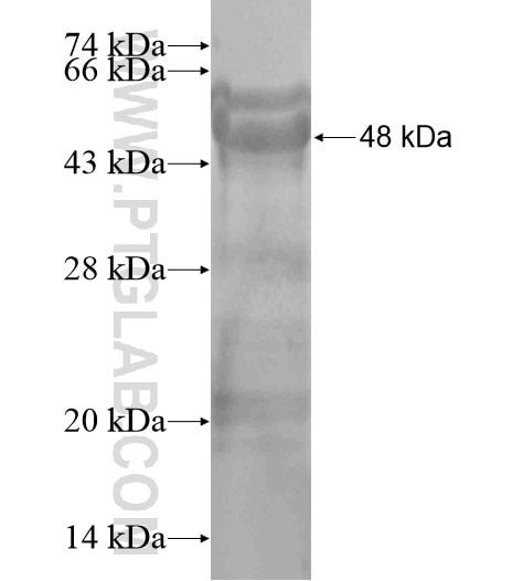 TSPYL3 fusion protein Ag19312 SDS-PAGE