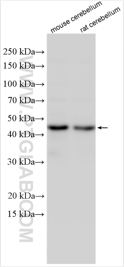 Western Blot (WB) analysis of various lysates using TSPYL4 Polyclonal antibody (17576-1-AP)