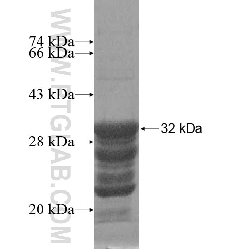 TSPYL4 fusion protein Ag10730 SDS-PAGE