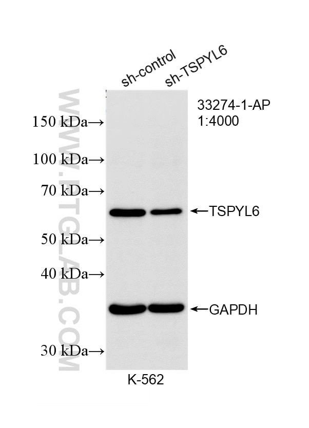 WB result of TSPYL6 antibody (33274-1-AP; 1:4000; incubated at room temperature for 1.5 hours) with sh-Control and sh-TSPYL6 transfected K-562 cells. Western Blot (WB) analysis of K-562 cells using TSPYL6 Polyclonal antibody (33274-1-AP)