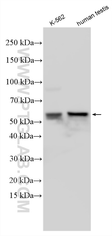 Various lysates were subjected to SDS PAGE followed by western blot with 33274-1-AP (TSPYL6 antibody) at dilution of 1:1500 incubated at room temperature for 1.5 hours. Western Blot (WB) analysis of various lysates using TSPYL6 Polyclonal antibody (33274-1-AP)