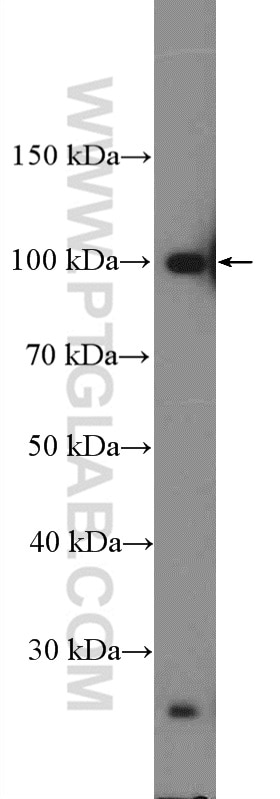 Western Blot (WB) analysis of L02 cells using TSR1 Polyclonal antibody (16887-1-AP)