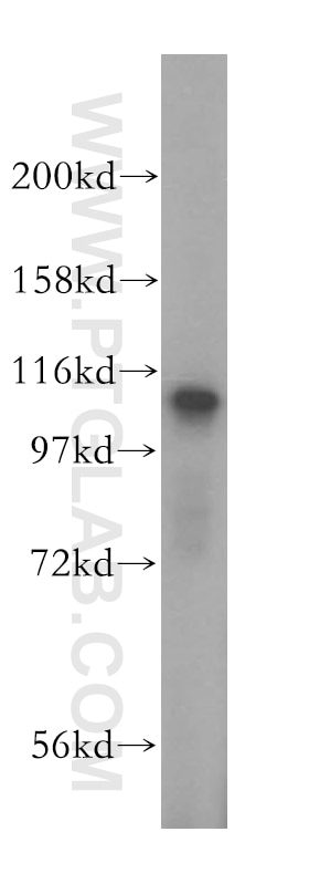 TSR1 Polyclonal antibody
