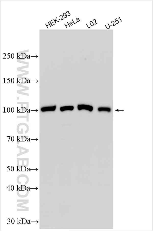 Western Blot (WB) analysis of various lysates using TSR1 Polyclonal antibody (29957-1-AP)