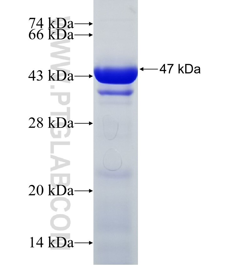TSR1 fusion protein Ag31575 SDS-PAGE
