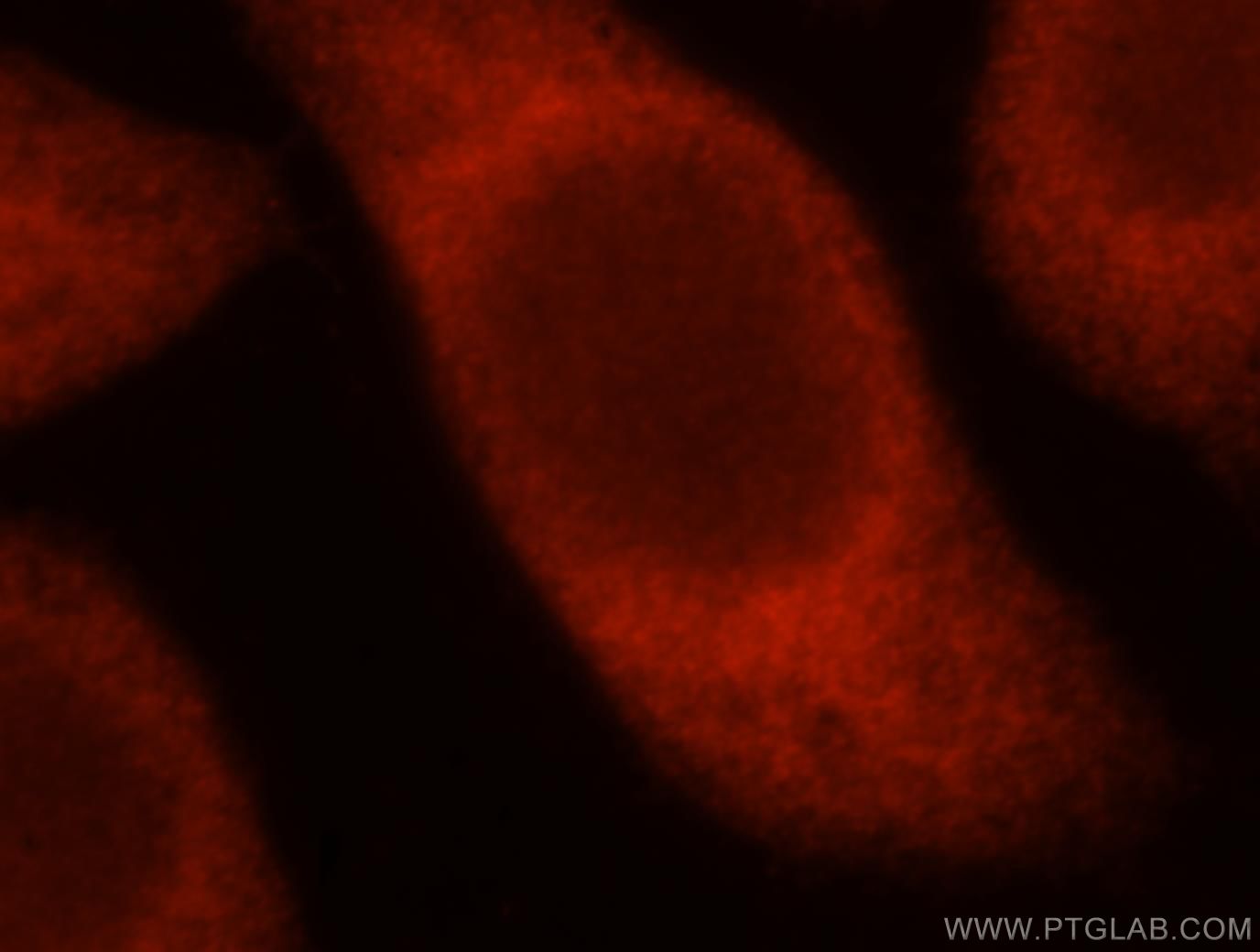 Immunofluorescence (IF) / fluorescent staining of MCF-7 cells using TSR2 Polyclonal antibody (16263-1-AP)