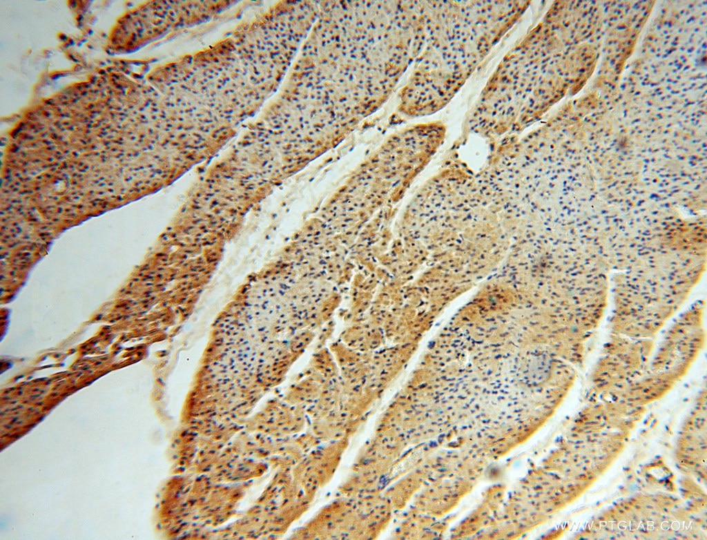 Immunohistochemistry (IHC) staining of human heart tissue using TSR2 Polyclonal antibody (16263-1-AP)