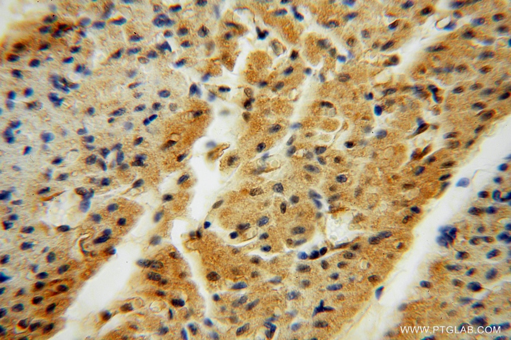 Immunohistochemistry (IHC) staining of human heart tissue using TSR2 Polyclonal antibody (16263-1-AP)