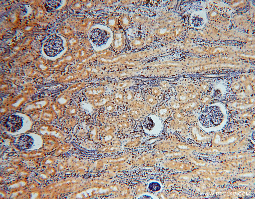 Immunohistochemistry (IHC) staining of human kidney tissue using TSR2 Polyclonal antibody (16263-1-AP)