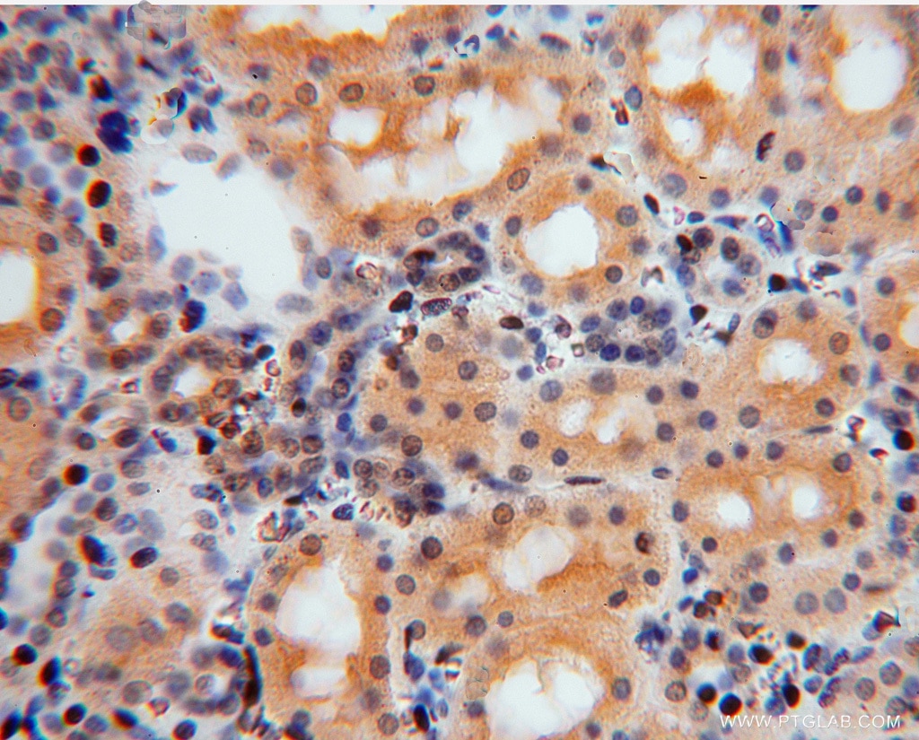 IHC staining of human kidney using 16263-1-AP