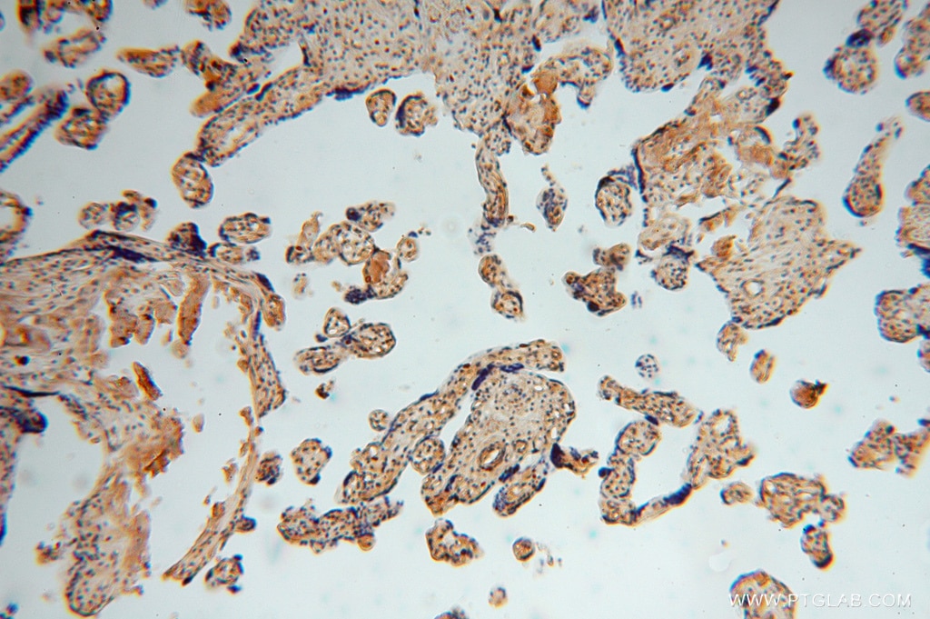 Immunohistochemistry (IHC) staining of human placenta tissue using TSR2 Polyclonal antibody (16263-1-AP)