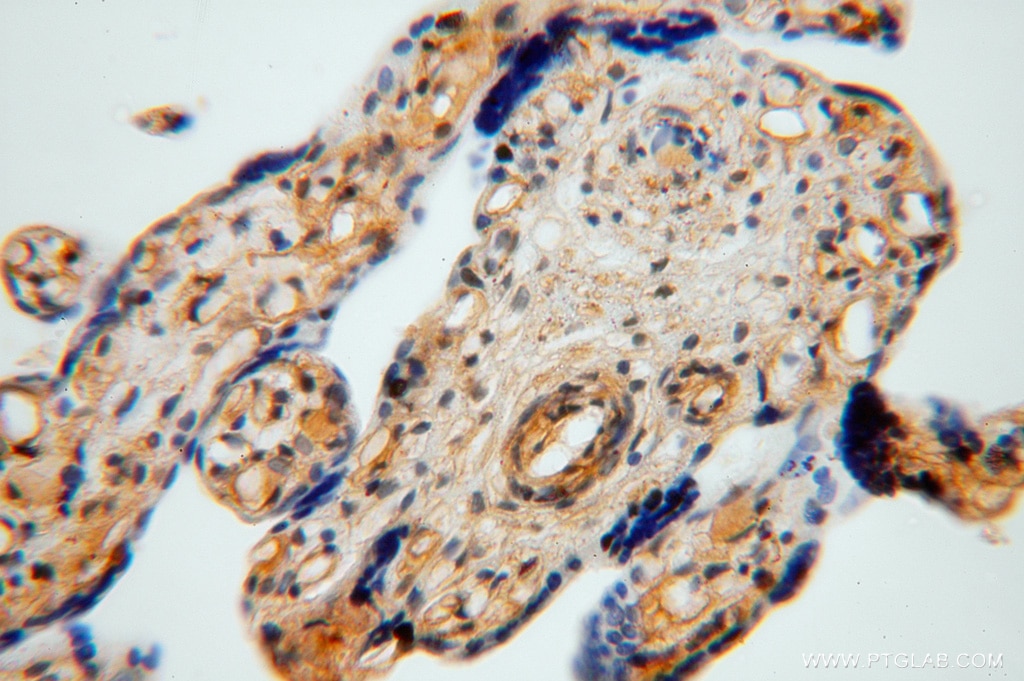 Immunohistochemistry (IHC) staining of human placenta tissue using TSR2 Polyclonal antibody (16263-1-AP)