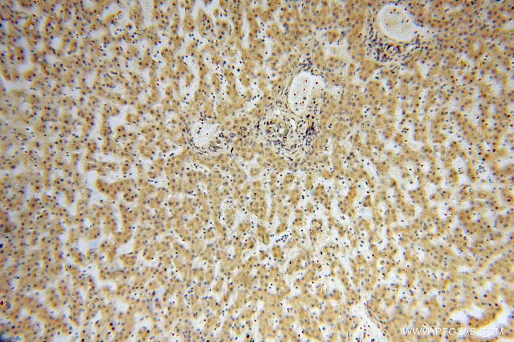 Immunohistochemistry (IHC) staining of human liver tissue using TSR2 Polyclonal antibody (16263-1-AP)