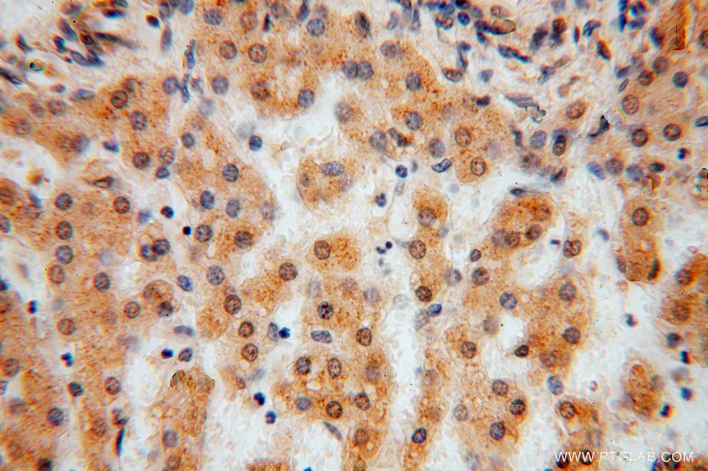 Immunohistochemistry (IHC) staining of human liver tissue using TSR2 Polyclonal antibody (16263-1-AP)