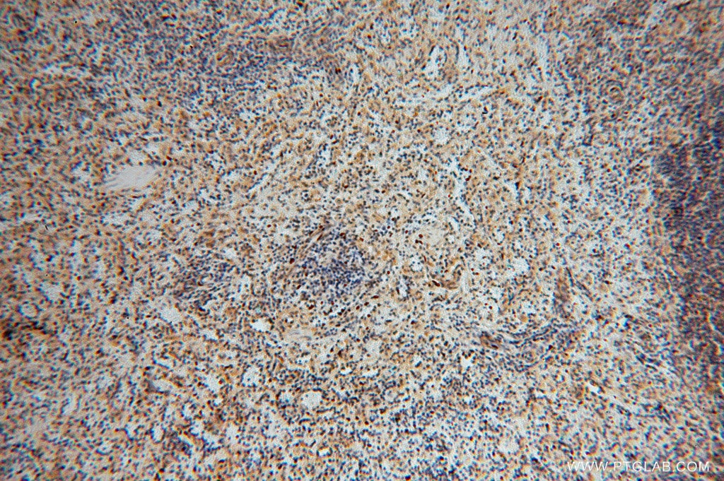 Immunohistochemistry (IHC) staining of human spleen tissue using TSR2 Polyclonal antibody (16263-1-AP)