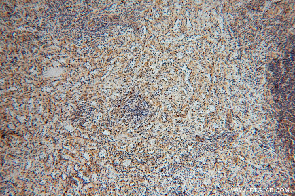 IHC staining of human spleen using 16263-1-AP