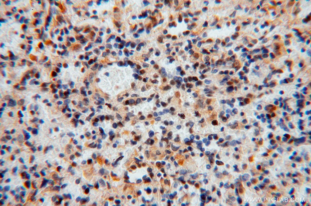 Immunohistochemistry (IHC) staining of human spleen tissue using TSR2 Polyclonal antibody (16263-1-AP)