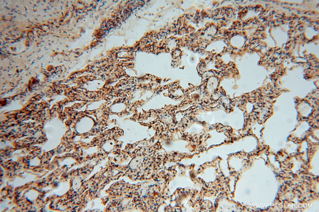 Immunohistochemistry (IHC) staining of human lung tissue using TSR2 Polyclonal antibody (16263-1-AP)