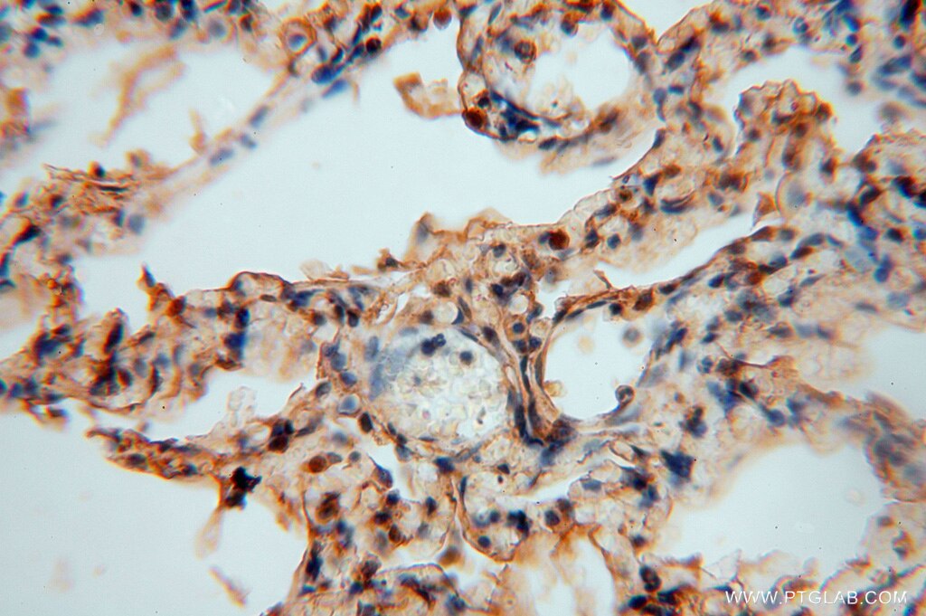 IHC staining of human lung using 16263-1-AP