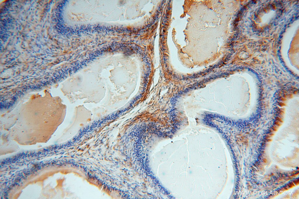 Immunohistochemistry (IHC) staining of human epididymis tissue using TSR2 Polyclonal antibody (16263-1-AP)