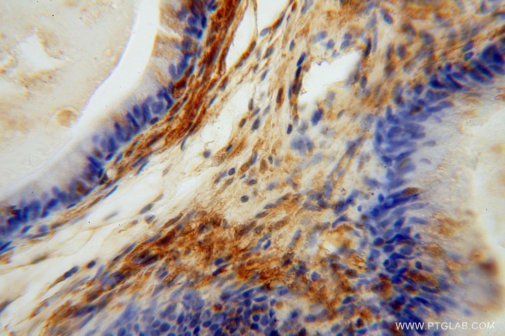 IHC staining of human epididymis using 16263-1-AP