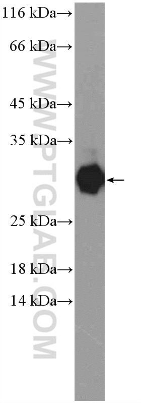 Western Blot (WB) analysis of HEK-293 cells using TSR2 Polyclonal antibody (16263-1-AP)