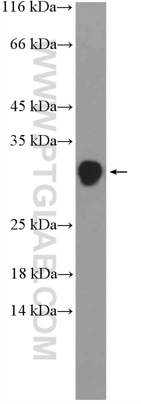 Western Blot (WB) analysis of mouse kidney tissue using TSR2 Polyclonal antibody (16263-1-AP)