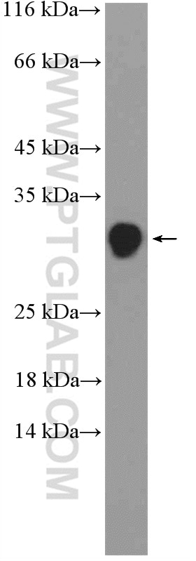 WB analysis of mouse kidney using 16263-1-AP