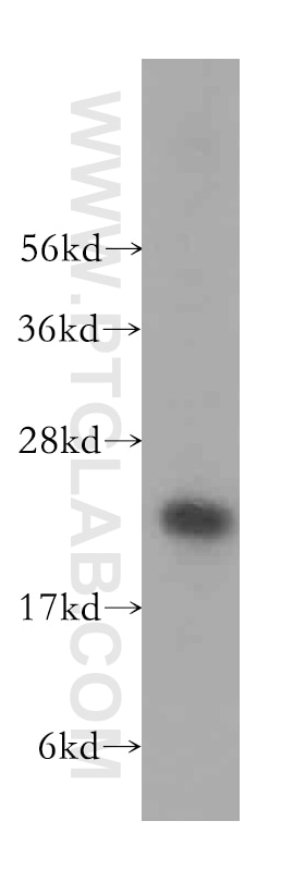 Western Blot (WB) analysis of HeLa cells using TSR2 Polyclonal antibody (16263-1-AP)