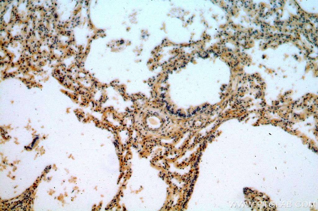 Immunohistochemistry (IHC) staining of human lung tissue using TSSC4 Polyclonal antibody (14531-1-AP)