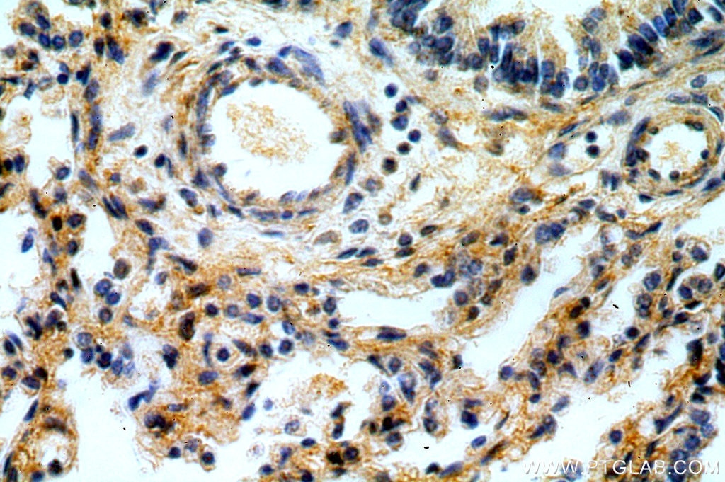 Immunohistochemistry (IHC) staining of human lung tissue using TSSC4 Polyclonal antibody (14531-1-AP)