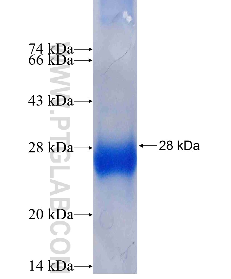 TSSK2 fusion protein Ag5162 SDS-PAGE
