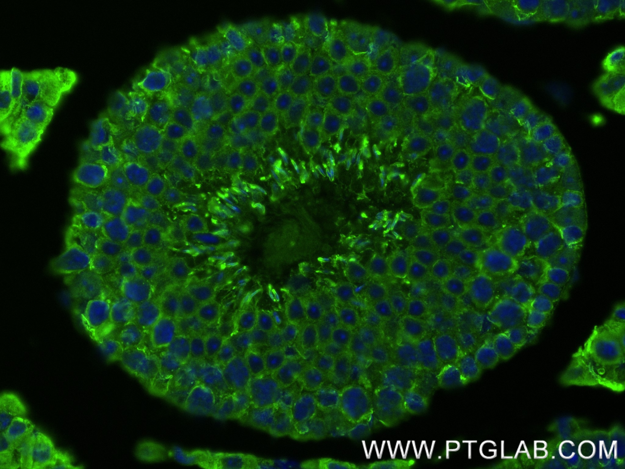 Immunofluorescence (IF) / fluorescent staining of mouse testis tissue using TSSK4 Recombinant antibody (83401-4-RR)
