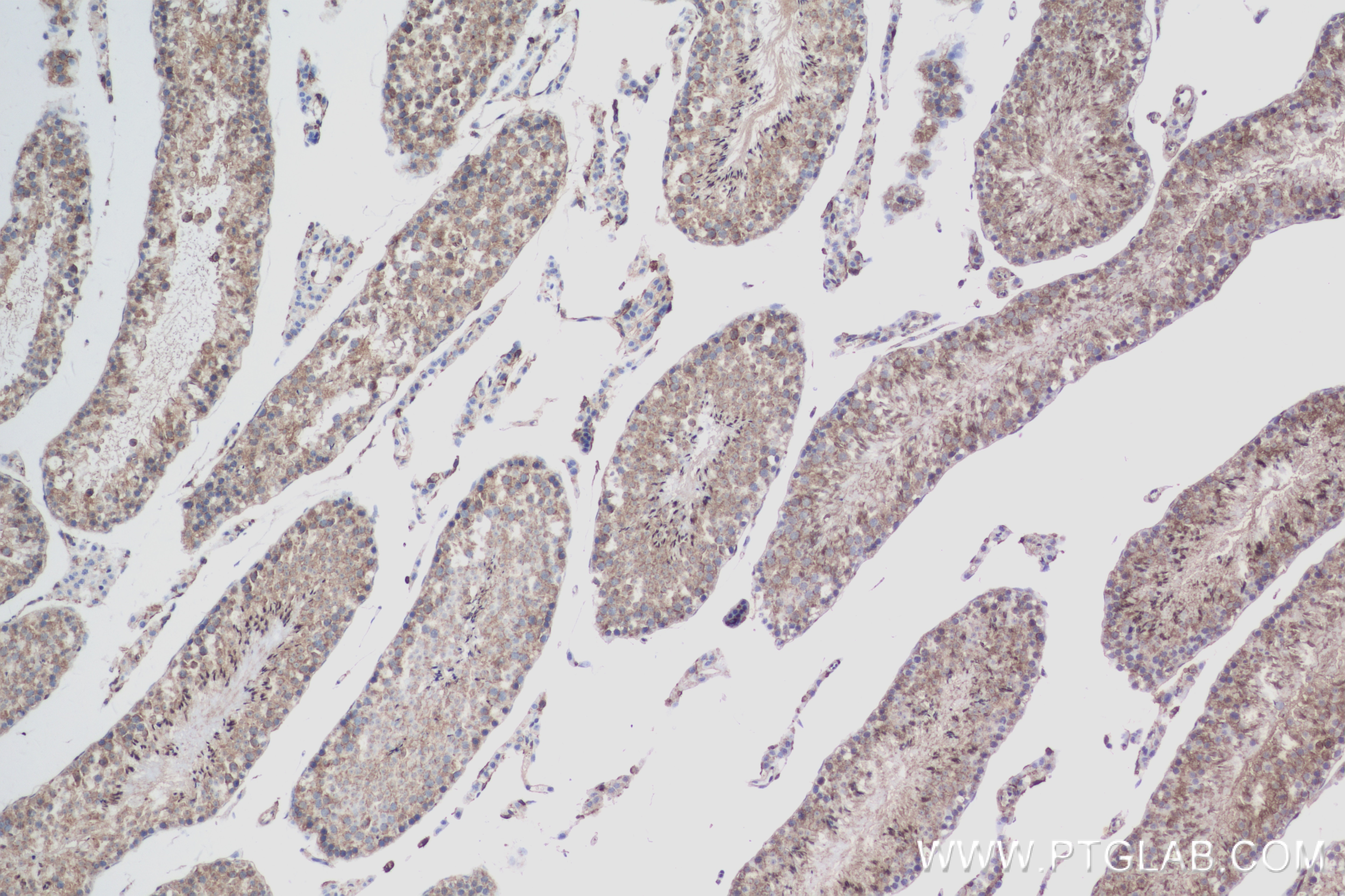 Immunohistochemistry (IHC) staining of mouse testis tissue using TSSK4 Recombinant antibody (83401-4-RR)