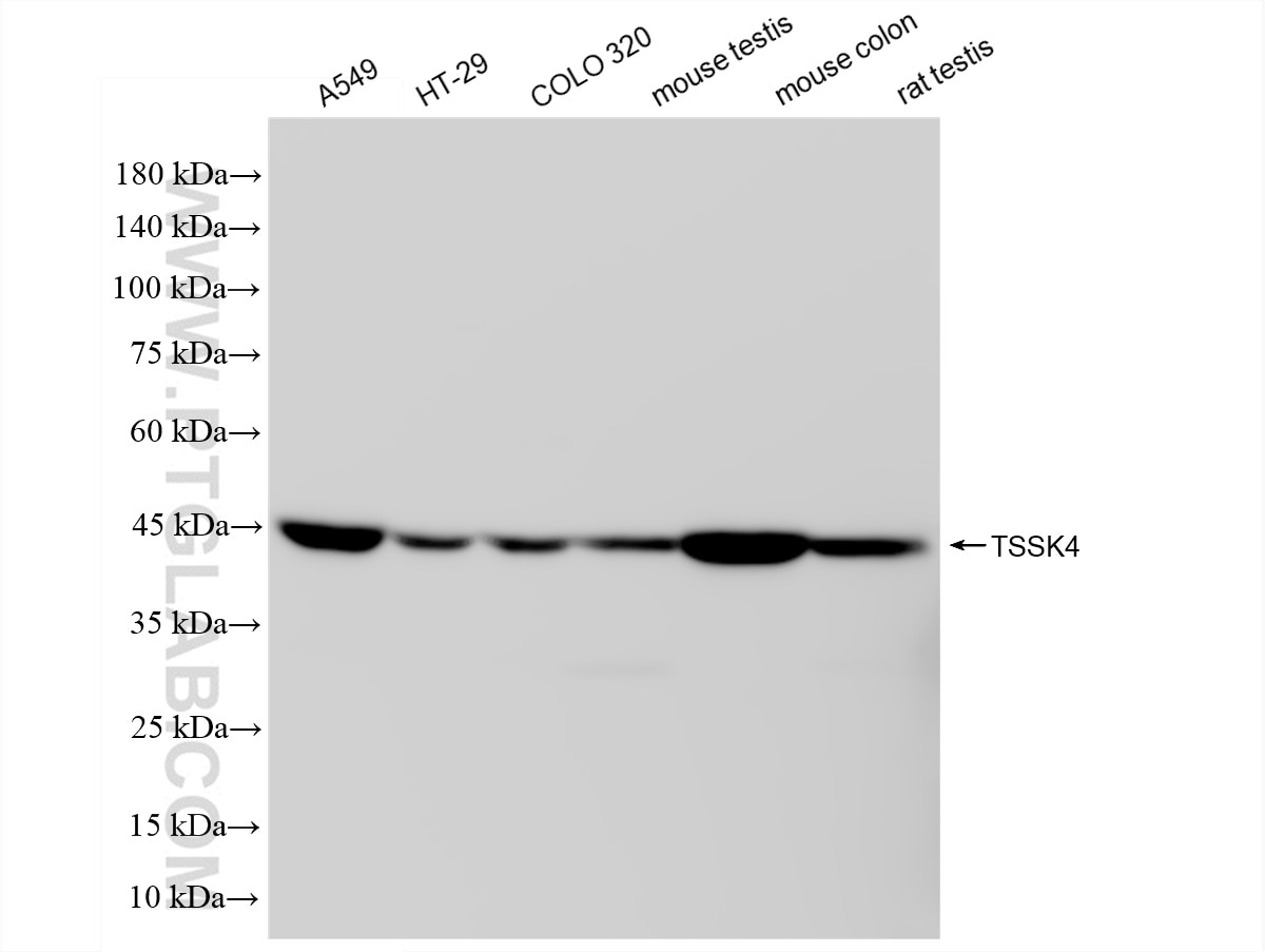 Western Blot (WB) analysis of various lysates using TSSK4 Recombinant antibody (83401-4-RR)