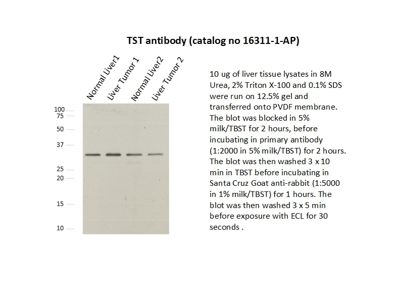 Western Blot (WB) analysis of liver tissue using TST Polyclonal antibody (16311-1-AP)