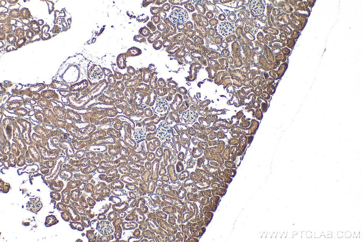 Immunohistochemistry (IHC) staining of mouse kidney tissue using TST Polyclonal antibody (16311-1-AP)