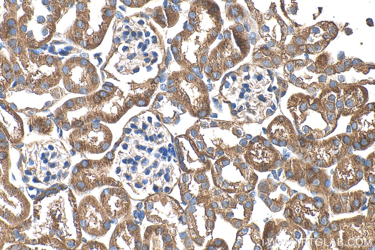 Immunohistochemistry (IHC) staining of mouse kidney tissue using TST Polyclonal antibody (16311-1-AP)
