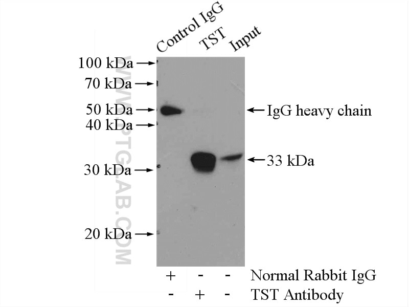 Immunoprecipitation (IP) experiment of HEK-293 cells using TST Polyclonal antibody (16311-1-AP)