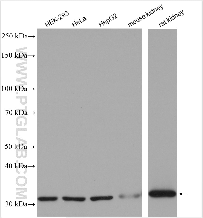 Western Blot (WB) analysis of various lysates using TST Polyclonal antibody (16311-1-AP)