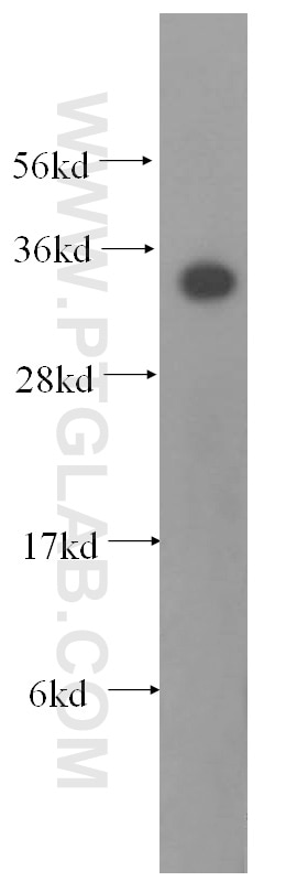 Western Blot (WB) analysis of human kidney tissue using TST Polyclonal antibody (16311-1-AP)