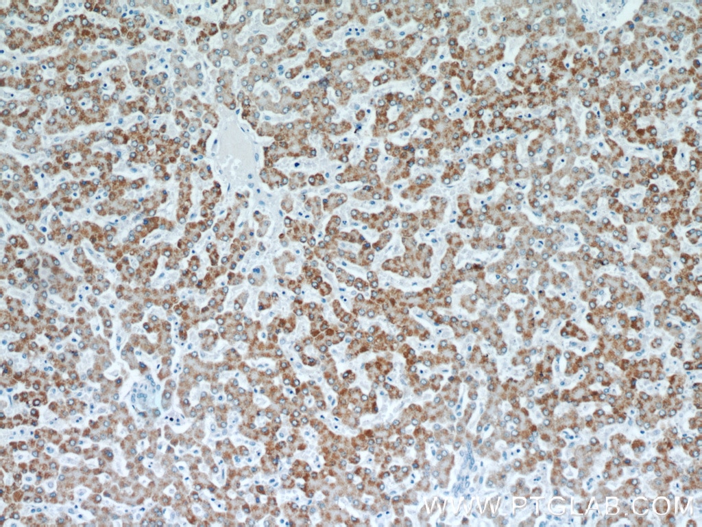 Immunohistochemistry (IHC) staining of human liver tissue using TST Monoclonal antibody (66018-1-Ig)