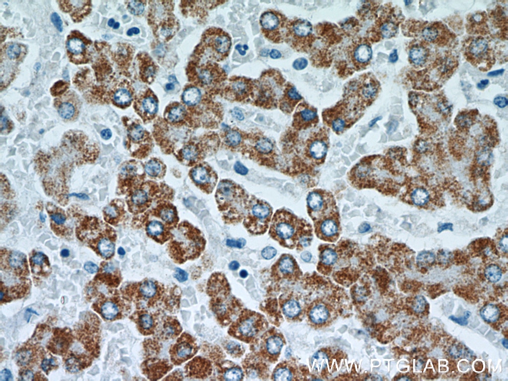 Immunohistochemistry (IHC) staining of human liver tissue using TST Monoclonal antibody (66018-1-Ig)