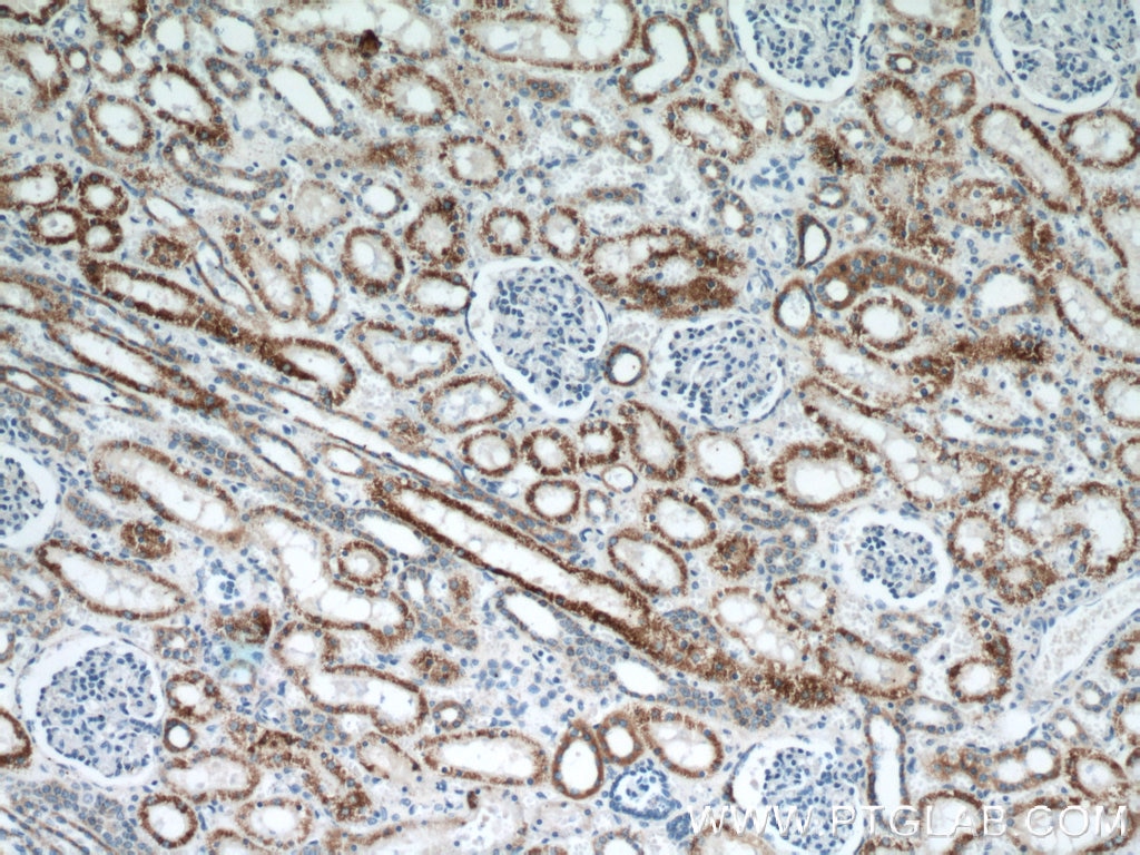 Immunohistochemistry (IHC) staining of human kidney tissue using TST Monoclonal antibody (66018-1-Ig)