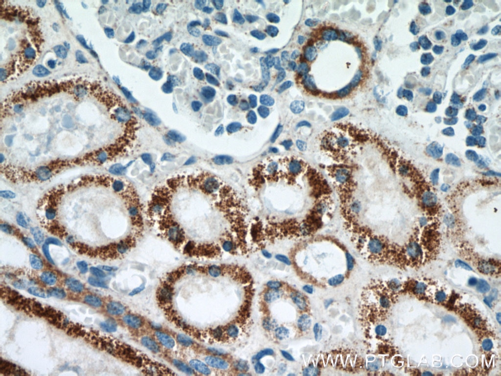 Immunohistochemistry (IHC) staining of human kidney tissue using TST Monoclonal antibody (66018-1-Ig)
