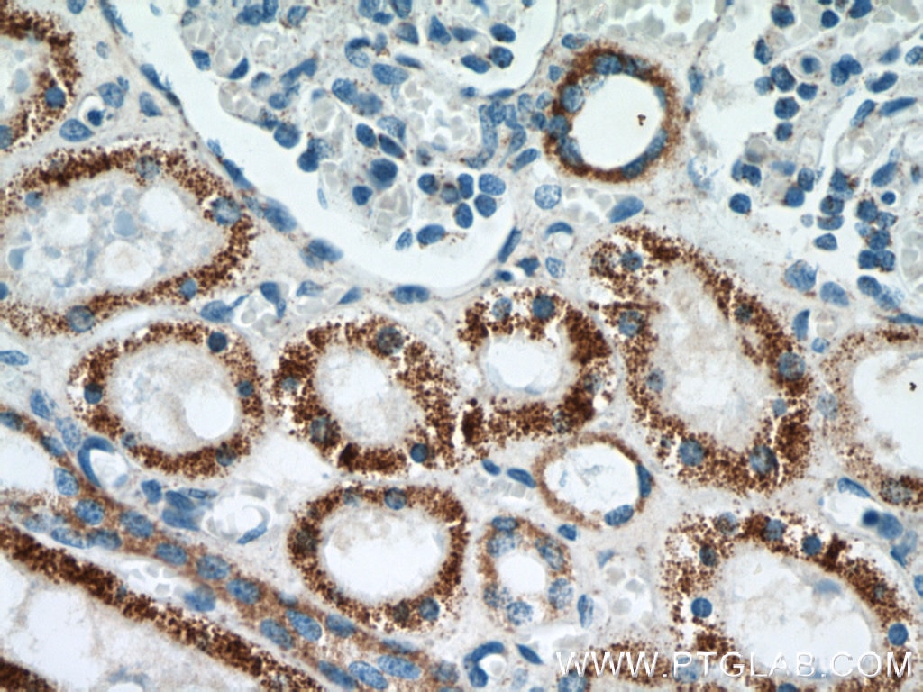 Immunohistochemistry (IHC) staining of human kidney tissue using TST Monoclonal antibody (66018-1-Ig)